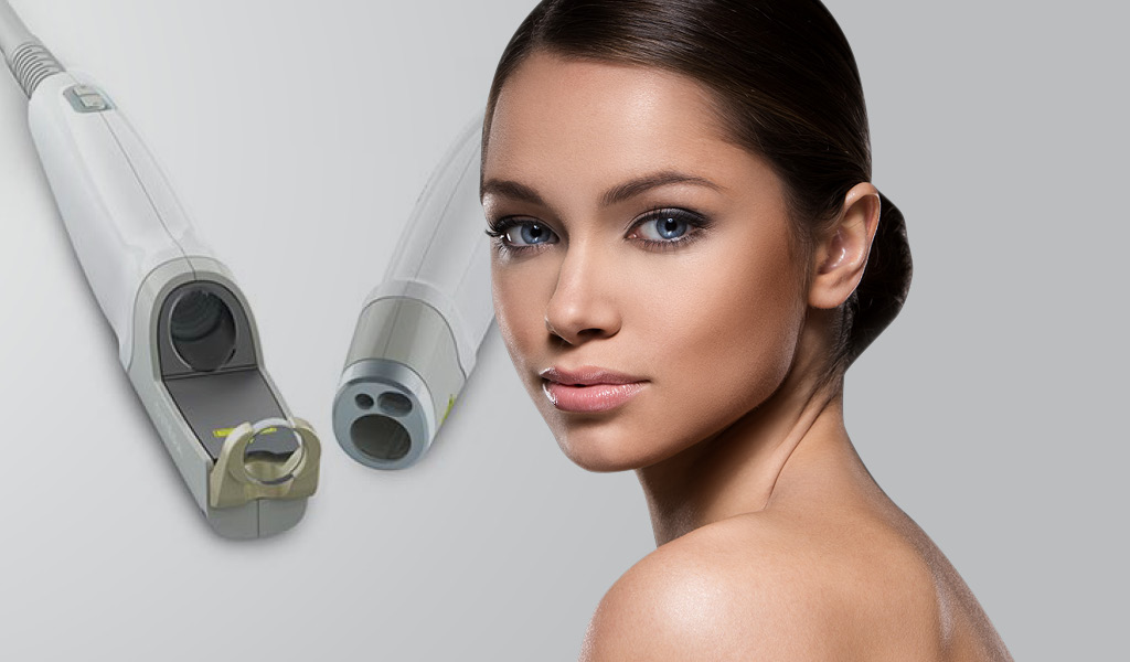 Facial Laser Treatment Toowoomba Gold Coast Vinesse